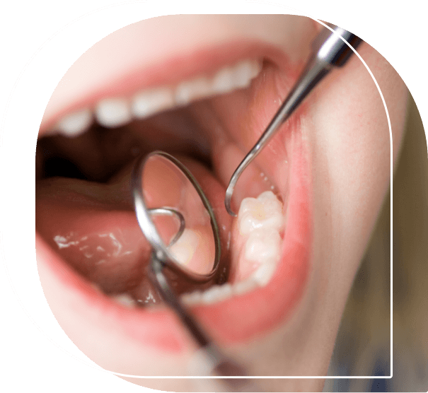 Close up of a child receiving a dental exam