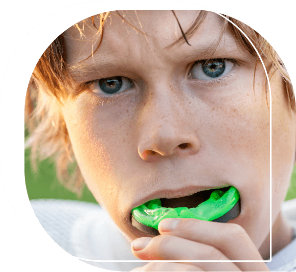 Young boy placing a green athletic mouthguard over his teeth