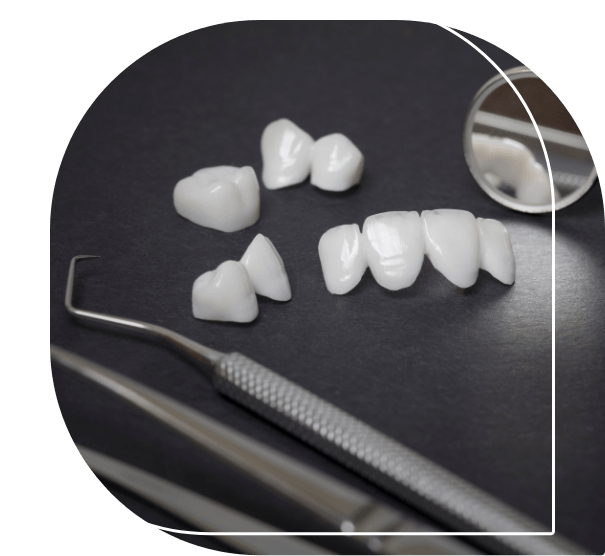 Several white dental crowns and veneers on table next to dental instruments