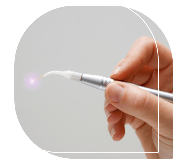 Hand holding a pen like dental laser device