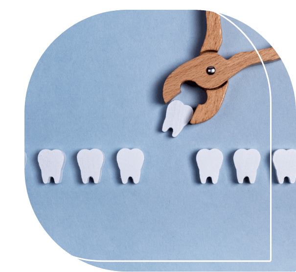 Illustration of a wooden clasp pulling a wooden tooth out of a row of teeth